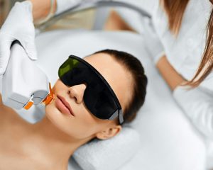 photofacial