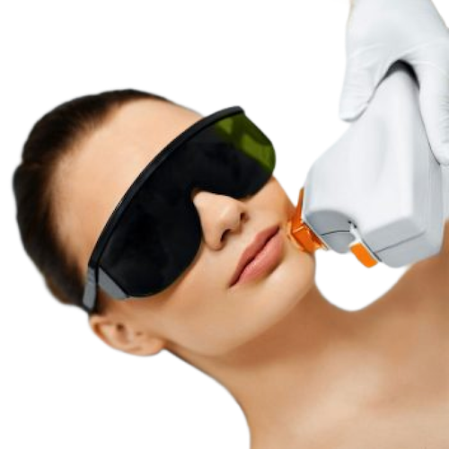 IPL Photofacial